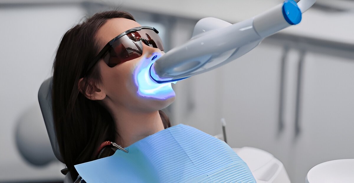 Teeth Cleaning Edmonton