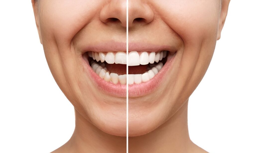 Cosmetic Dentistry Glenora